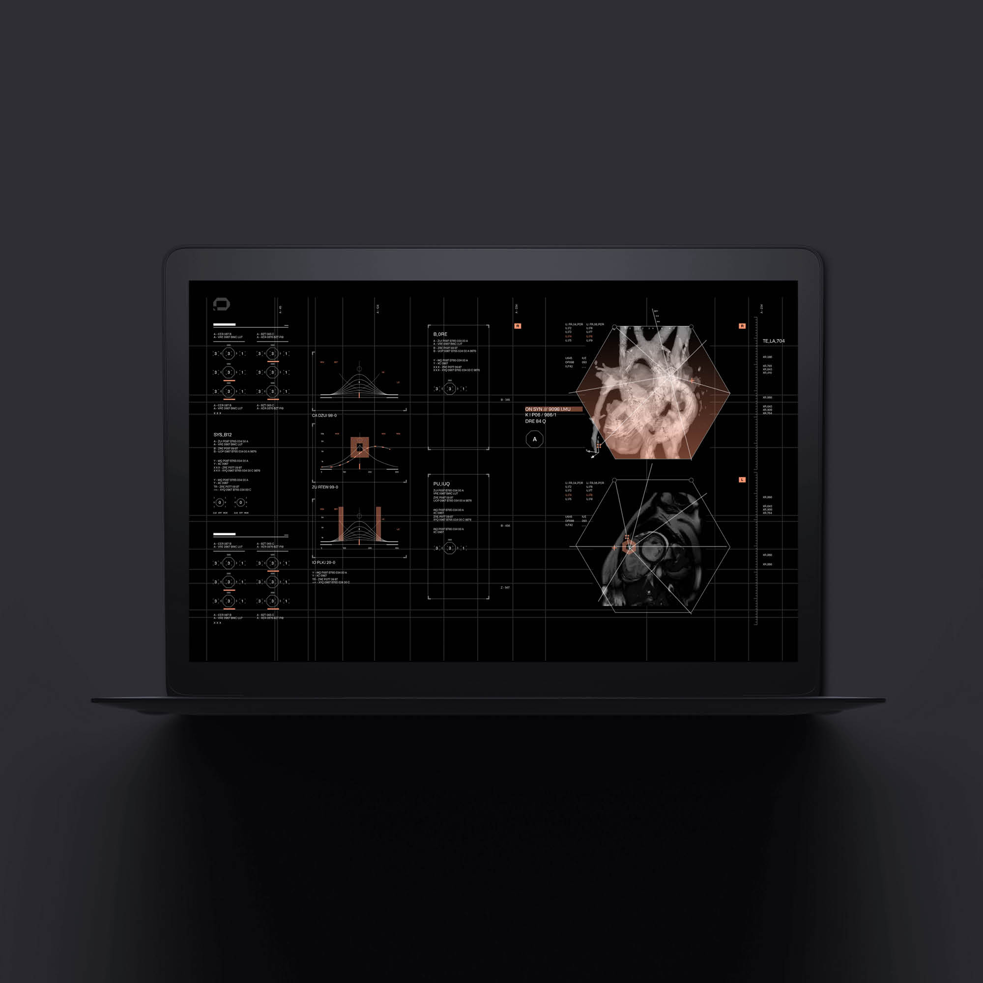 Interface_Cardiac_mockup_I